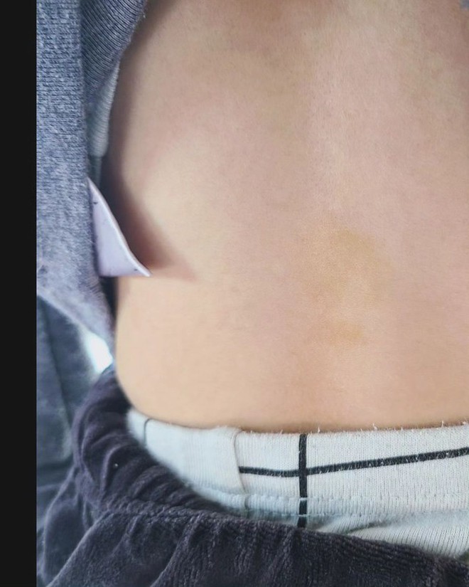 Ahreum tung bằng chứng chồng cũ bạo hành mẹ con cô, tuy nhiên kết quả điều tra cho thấy khả năng lớn cựu idol này đã dựng chuyện, khai man