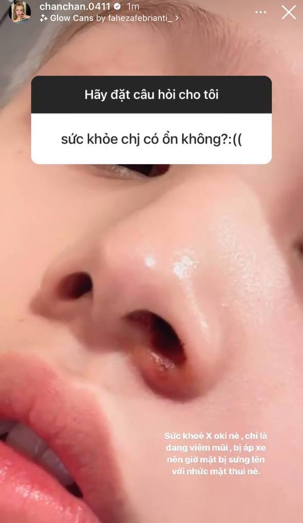 Tình hình sức khỏe của Xoài Non gần đây khá bất ổn