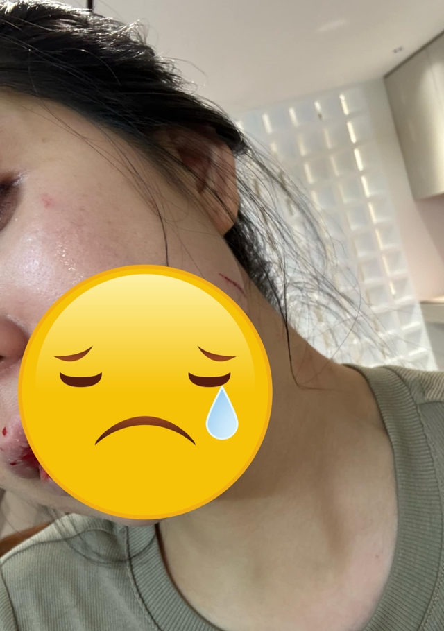 Hằng Du Mục bị Tôn Bằng bạo hành gây phẫn nộ