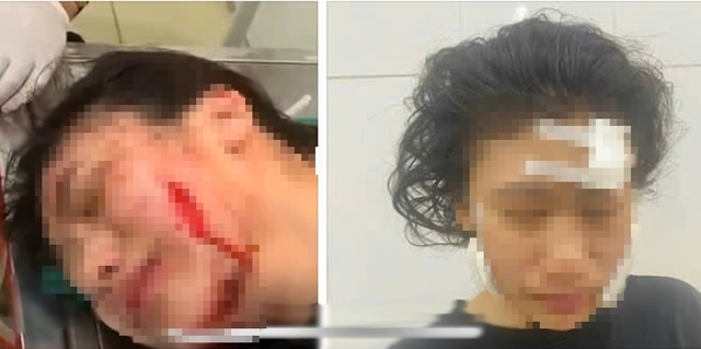 Thiếu nữ 17 tuổi là con gái của bà H. bị 