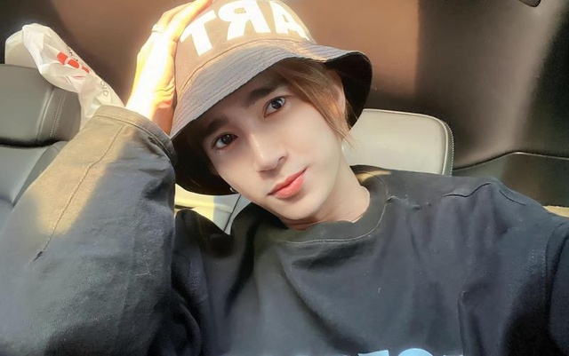 Nam ca sĩ sinh năm 1989 còn từng vướng nghi vấn phẫu thuật thẩm mỹ vì ngoại hình khác lạ