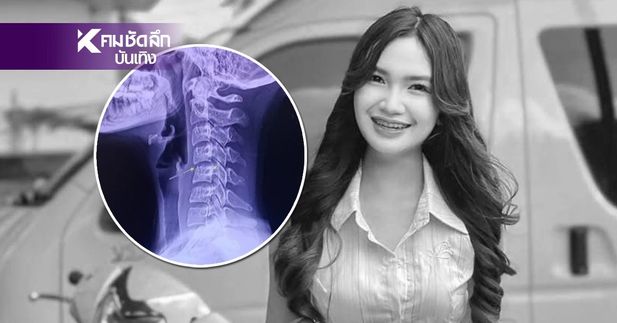 Bác sĩ đầu tiên thăm khám cho nữ ca sĩ đã bỏ qua dấu hiệu cũng như không cho Ping Chayada chụp X-quang để xác định cô có bị trật đốt sống cổ hay không.