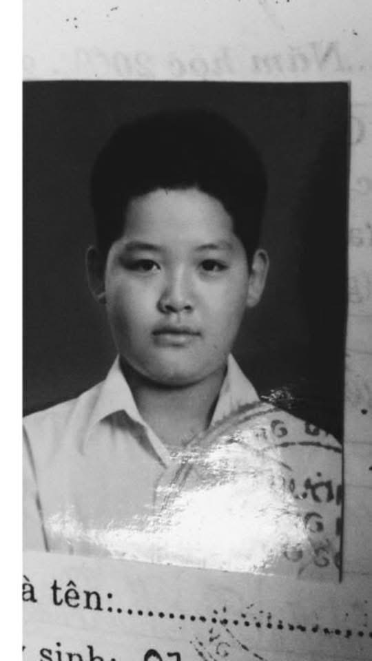 WEAN từng là nạn nhân miệt thị ngoại hình vì đôi môi dày