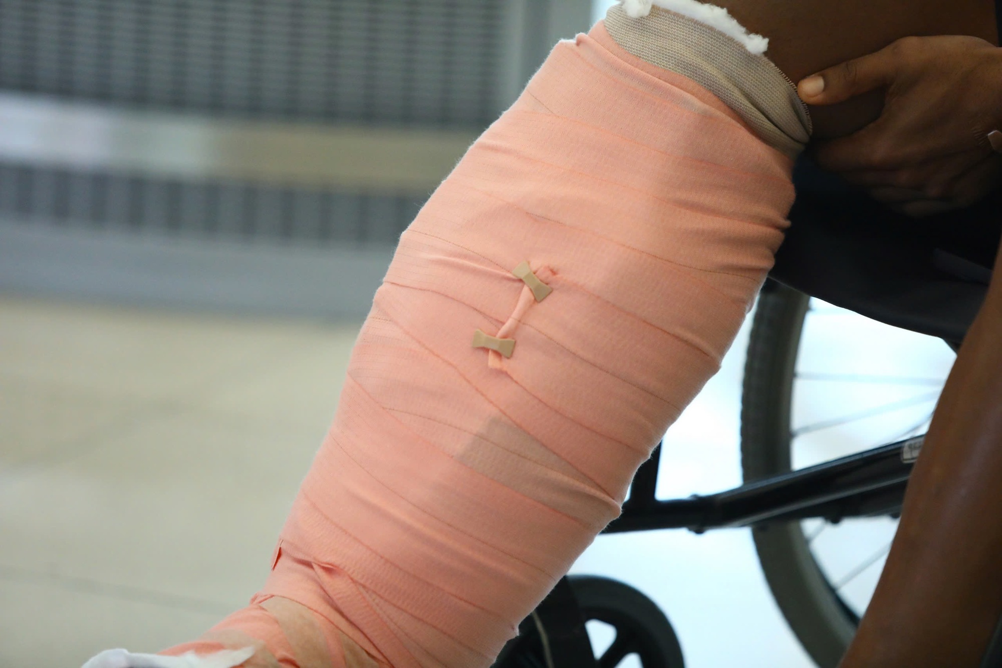 Xuân Son bị gãy 2 xương chân phải