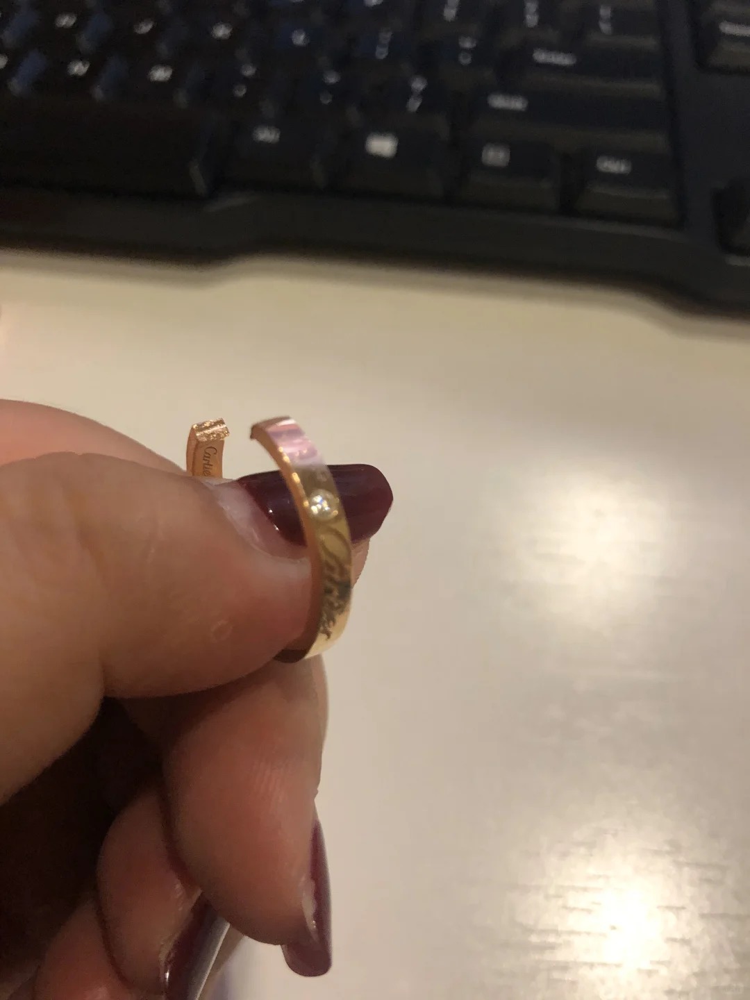 Nữ blogger đã phải cắt chiếc nhẫn cưới mới có thể lấy ra khỏi tay