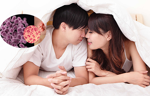 Quan hệ tình dục không an toàn gieo rắc bệnh lậu khắp thế giới Quan hệ tình dục không an toàn gieo rắc bệnh lậu khắp thế giới