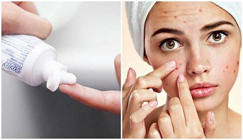 Bỏ túi ngay 15 mẹo làm đẹp giúp chị em phụ nữ đẹp hơn mỗi khi ra đường - 10 Bỏ túi ngay 15 mẹo làm đẹp giúp chị em phụ nữ đẹp hơn mỗi khi ra đường - 10