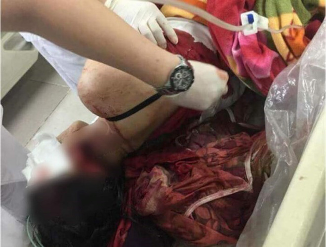 Sức khỏe người vợ bị chồng chém dã man ở Phú Thọ giờ ra sao?