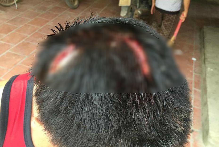 Người đàn ông bị 2 kẻ côn đồ bắt quỳ lạy, dùng hung khí đánh dã man ở Bắc Giang