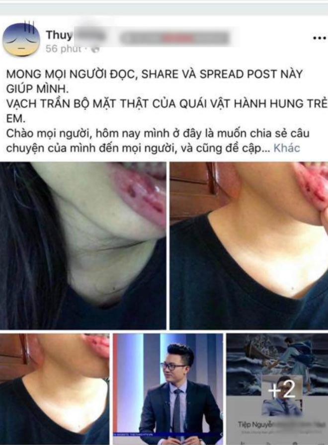 Nữ sinh tố anh rể BTV bạo hành: Chuyện Thùy D bị đánh nhóm bạn thân đã biết từ lâu