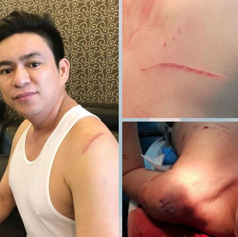 Phía sau bản hợp đồng thuê giang hồ truy sát bác sĩ Chiêm Quốc Thái