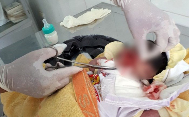Bố bé trai bị mẹ chôn sống: 'Lúc nó nói có bầu, lúc nói không có, ai biết đâu mà lần' Bố bé trai bị mẹ chôn sống: 'Lúc nó nói có bầu, lúc nói không có, ai biết đâu mà lần'