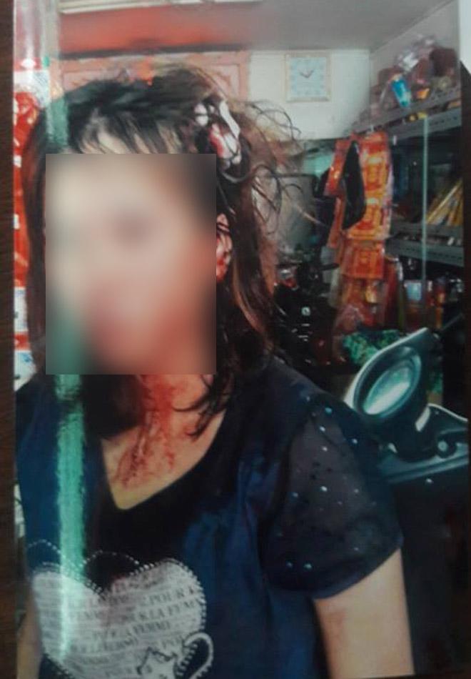 TP.HCM: Vợ bị bồ nhí của chồng đánh ghen ngược, dùng tuýp sắt đánh đập dã man