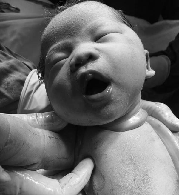 Bé Sài Gòn chào đời với dây rốn quấn chặt cổ: Các mẹ hốt hoảng, bác sĩ bảo 'chuyện thường' - 1 Bé Sài Gòn chào đời với dây rốn quấn chặt cổ: Các mẹ hốt hoảng, bác sĩ bảo 'chuyện thường' - 1