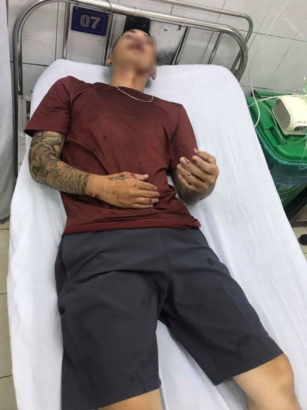 Nhóm côn đồ truy sát khiến 2 cha con phải nhập viện cấp cứu