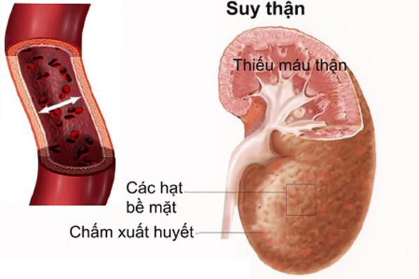 Cụ bà 'nôn thốc nôn tháo' vì ăn dứa mỗi ngày, loại quả này không phải ai cũng ăn được - 1 Cụ bà 'nôn thốc nôn tháo' vì ăn dứa mỗi ngày, loại quả này không phải ai cũng ăn được - 1