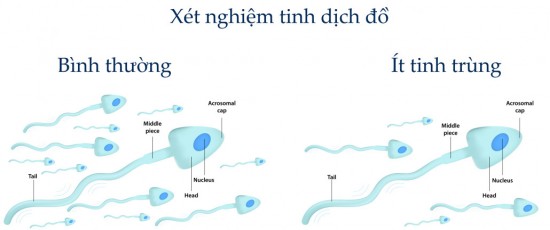 Mãn dục nam - Hiểu để ứng phó phù hợp - 1 Mãn dục nam - Hiểu để ứng phó phù hợp - 1