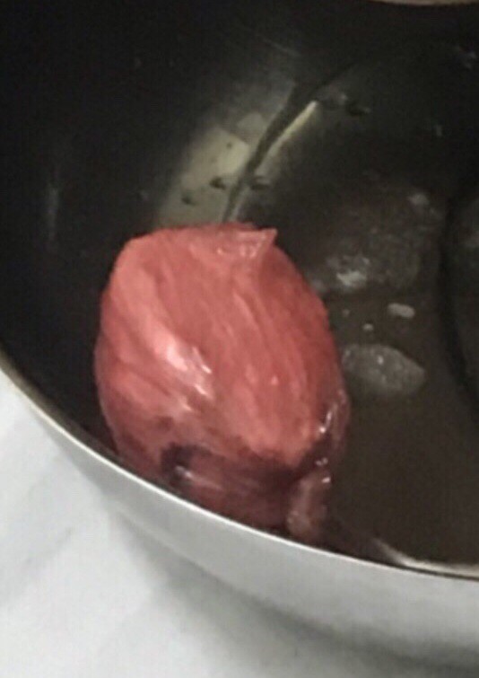 [CHUYỆN KHÓ TIN] 12 giờ giải cứu cục ma túy giấu trong vùng kín