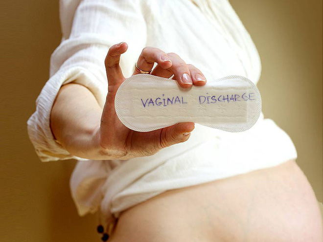 Khi nào thì dịch tiết âm đạo màu nâu có thể cảnh báo vấn đề nghiêm trọng: Những dấu hiệu không được bỏ qua Khi nào thì dịch tiết âm đạo màu nâu có thể cảnh báo vấn đề nghiêm trọng: Những dấu hiệu không được bỏ qua