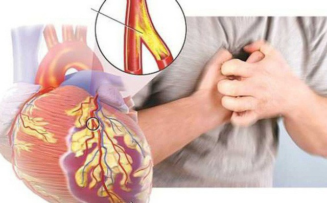 Những bệnh nguy hiểm người ăn nhiều thịt dễ mắc phải, cần điều chỉnh ngay - 1 Những bệnh nguy hiểm người ăn nhiều thịt dễ mắc phải, cần điều chỉnh ngay - 1