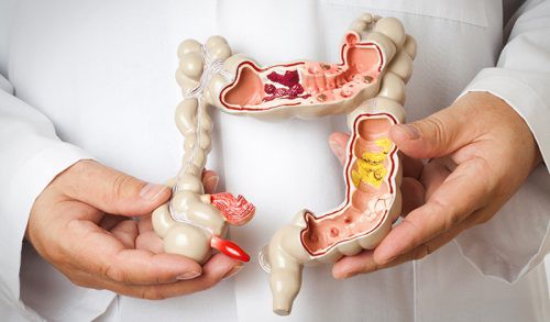 Những bệnh nguy hiểm người ăn nhiều thịt dễ mắc phải, cần điều chỉnh ngay - 4 Những bệnh nguy hiểm người ăn nhiều thịt dễ mắc phải, cần điều chỉnh ngay - 4