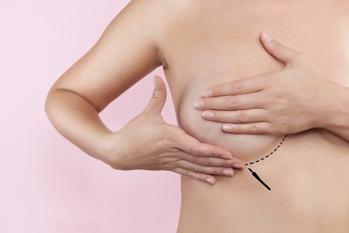 Ngực 'quả mướp' và những lầm tưởng của hầu hết mọi người - 1 Ngực 'quả mướp' và những lầm tưởng của hầu hết mọi người - 1