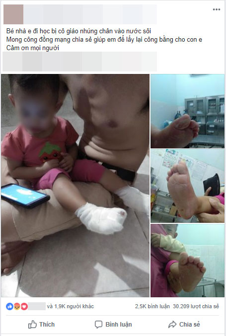 Gia đình bức xúc vì bé gái 2 tuổi nghi bị nhúng chân vào nước sôi tại trường mầm non ở Sài Gòn