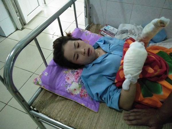 Giây phút kinh hoàng của người vợ bị chồng đổ xăng thiêu sống - 1 Giây phút kinh hoàng của người vợ bị chồng đổ xăng thiêu sống - 1