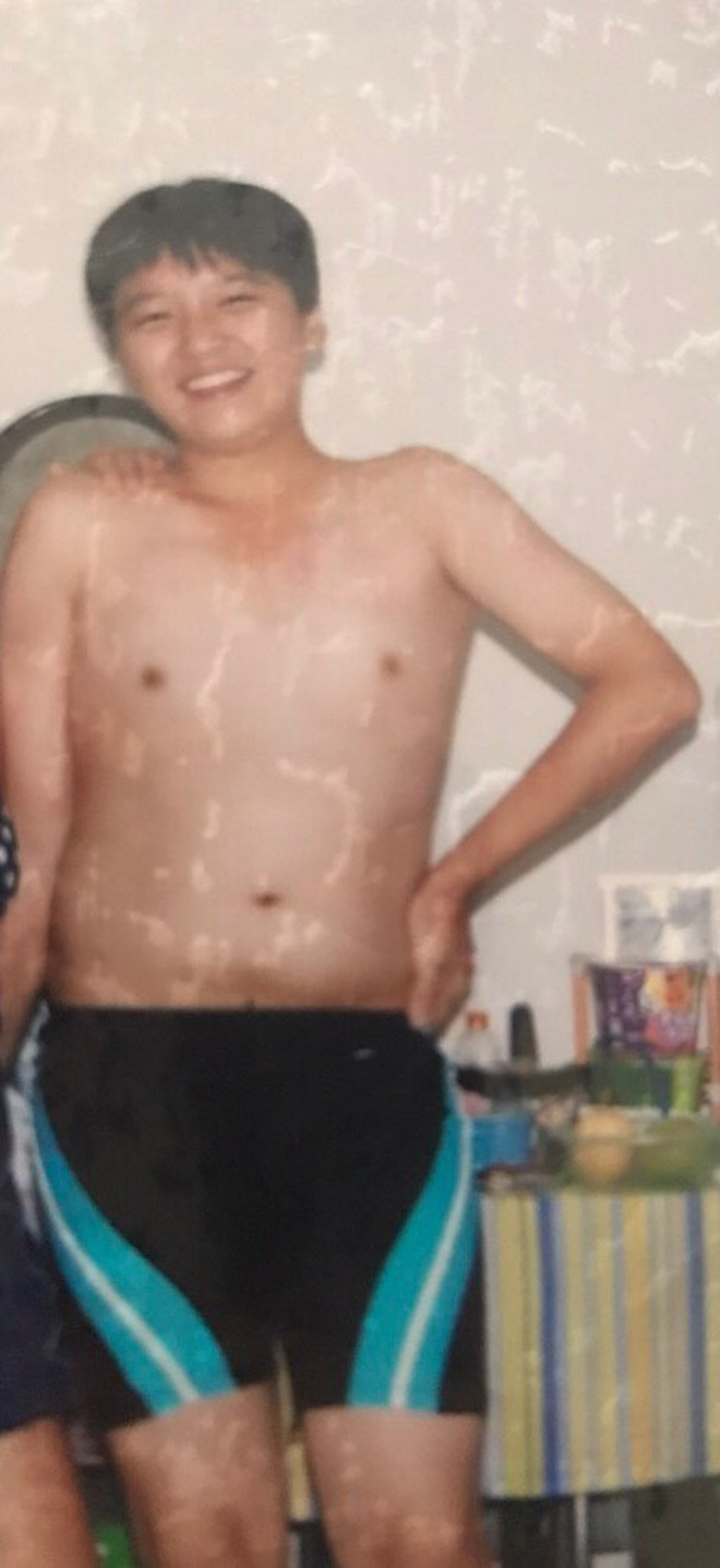 Từng bị bạn trêu đến sợ đi học vì béo, chàng trai giảm 20kg hóa hot boy đầy thu hút - 3 Từng bị bạn trêu đến sợ đi học vì béo, chàng trai giảm 20kg hóa hot boy đầy thu hút - 3