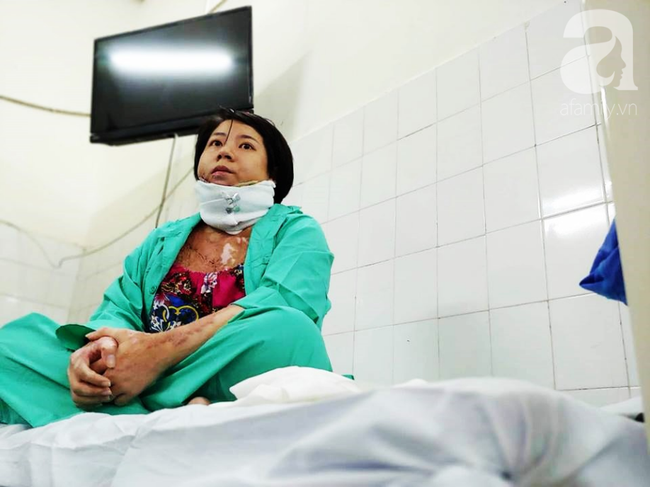 Người vợ bị chồng dùng xăng đốt vì níu kéo tình cảm không thành: 'Tết này em được về với con rồi' - 1 Người vợ bị chồng dùng xăng đốt vì níu kéo tình cảm không thành: 'Tết này em được về với con rồi' - 1