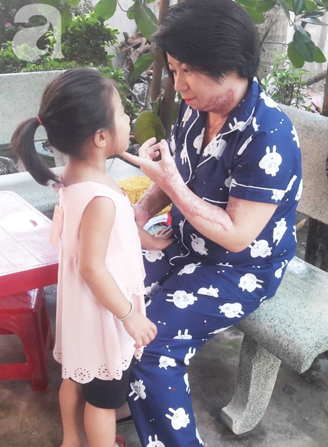 Người vợ bị chồng dùng xăng đốt vì níu kéo tình cảm không thành: 'Tết này em được về với con rồi' - 11 Người vợ bị chồng dùng xăng đốt vì níu kéo tình cảm không thành: 'Tết này em được về với con rồi' - 11