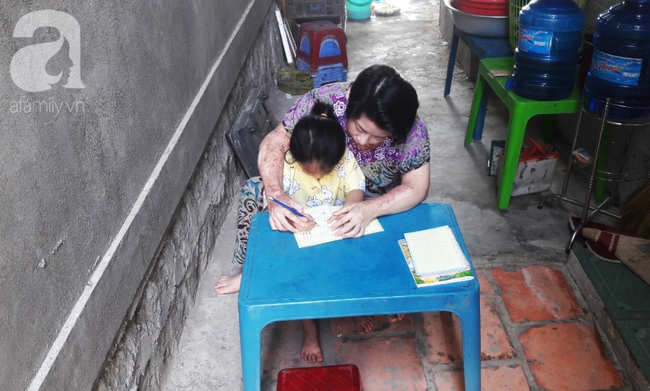 Người vợ bị chồng dùng xăng đốt vì níu kéo tình cảm không thành: 'Tết này em được về với con rồi' - 4 Người vợ bị chồng dùng xăng đốt vì níu kéo tình cảm không thành: 'Tết này em được về với con rồi' - 4