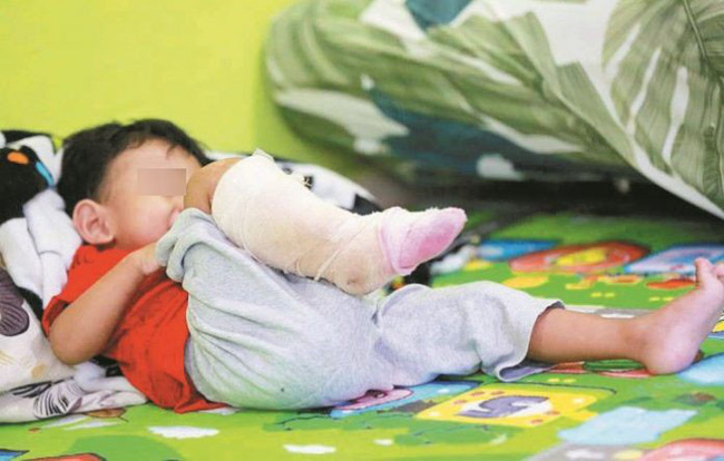 Con bị nhiễm vi khuẩn ăn thịt người, mẹ hối hận tột độ vì đã phớt lờ điều tưởng chừng như vô hại này - 1 Con bị nhiễm vi khuẩn ăn thịt người, mẹ hối hận tột độ vì đã phớt lờ điều tưởng chừng như vô hại này - 1