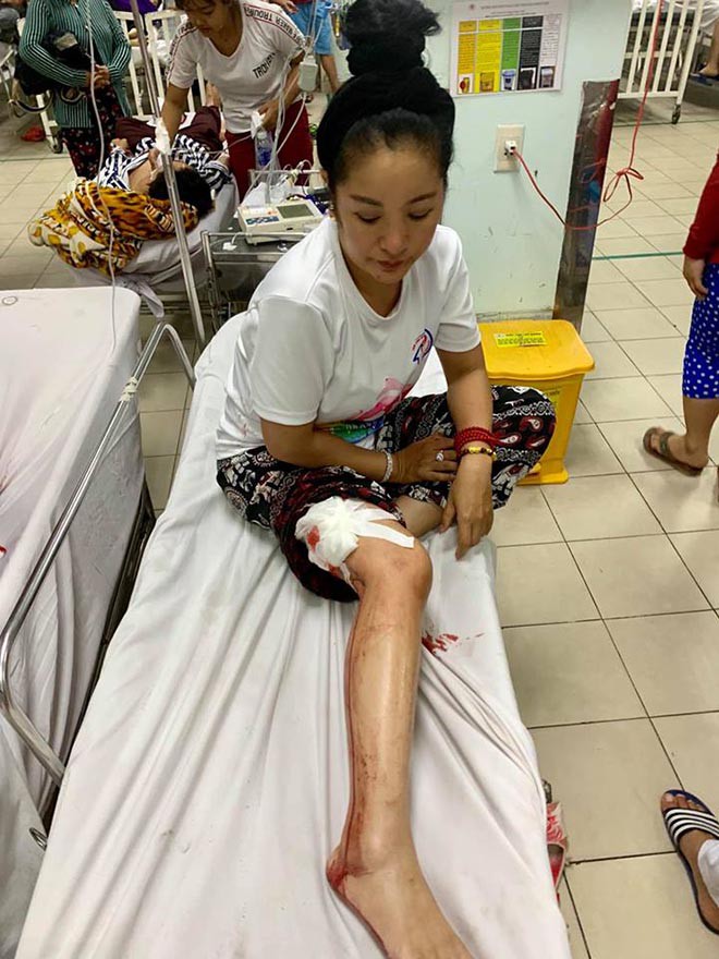 Danh hài Thúy Nga bị tai nạn, máu chảy đầm đìa phải cấp cứu - 1 Danh hài Thúy Nga bị tai nạn, máu chảy đầm đìa phải cấp cứu - 1