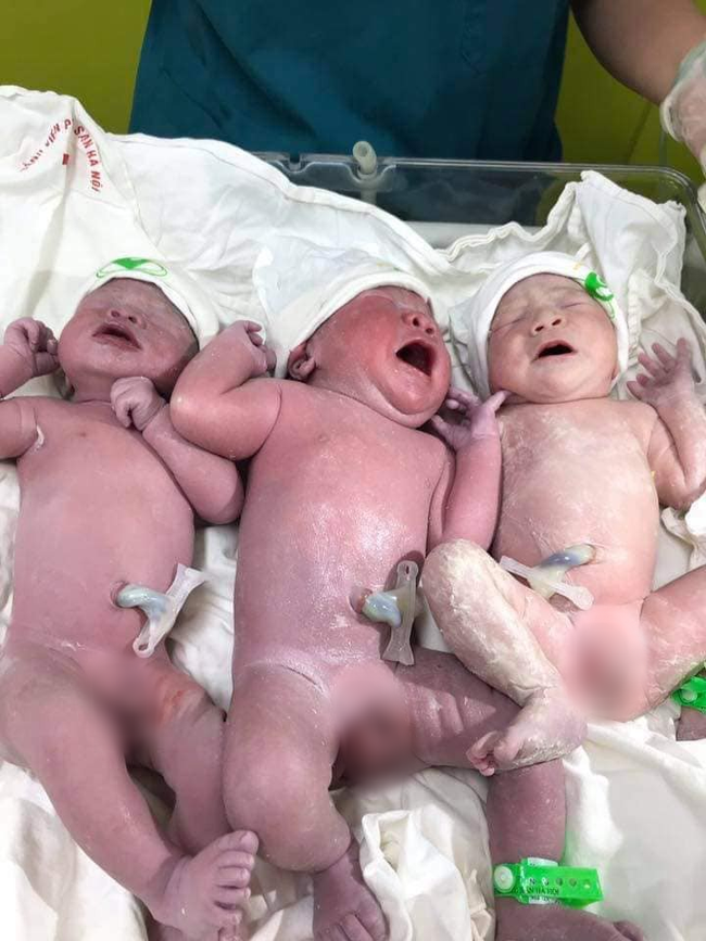 Hội bỉm sữa xôn xao trước ca sinh 3 'siêu tiết kiệm', đẻ một lần có đủ cả nếp lẫn tẻ Hội bỉm sữa xôn xao trước ca sinh 3 'siêu tiết kiệm', đẻ một lần có đủ cả nếp lẫn tẻ