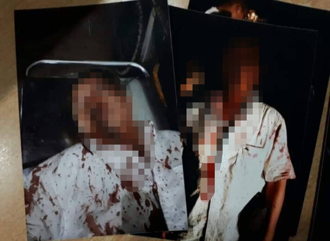 Bình Dương: Chồng bị đánh thừa sống thiếu chết, nghi do vợ đi vay nặng lãi tiền tỷ không trả