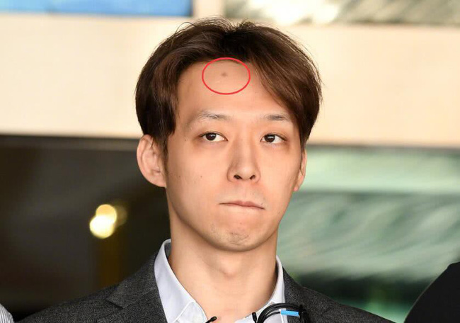 Yoochun dùng ma túy xong đập đầu vào tường, dấu vết còn y nguyên trên trán trong ngày bị còng tay? - 1 Yoochun dùng ma túy xong đập đầu vào tường, dấu vết còn y nguyên trên trán trong ngày bị còng tay? - 1
