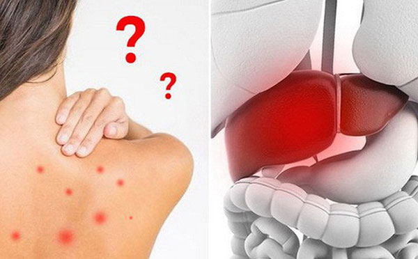 Khi bạn uống nước rồi những vẫn cảm thấy khát: Hãy cảnh giác với 5 căn bệnh nguy hiểm Khi bạn uống nước rồi những vẫn cảm thấy khát: Hãy cảnh giác với 5 căn bệnh nguy hiểm