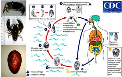 Từng có nhiều người được chẩn đoán bị nhiễm sán lá phổi do ăn tôm hùm đất - 3 Từng có nhiều người được chẩn đoán bị nhiễm sán lá phổi do ăn tôm hùm đất - 3
