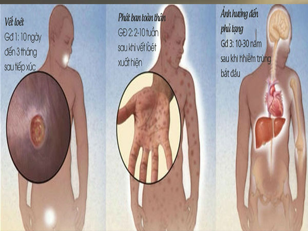 Quan hệ đồng giới, người đàn ông bị liệt mặt, tổn thương thần kinh - 1 Quan hệ đồng giới, người đàn ông bị liệt mặt, tổn thương thần kinh - 1
