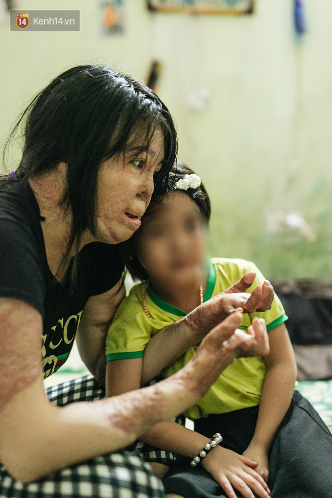 Cô gái trẻ bị chồng tưới xăng thiêu sống và lá thư muộn màng từ trại giam: 'Gần 3 năm anh chưa một lần dám viết thư cho em và hai con...' - 8 Cô gái trẻ bị chồng tưới xăng thiêu sống và lá thư muộn màng từ trại giam: 'Gần 3 năm anh chưa một lần dám viết thư cho em và hai con...' - 8