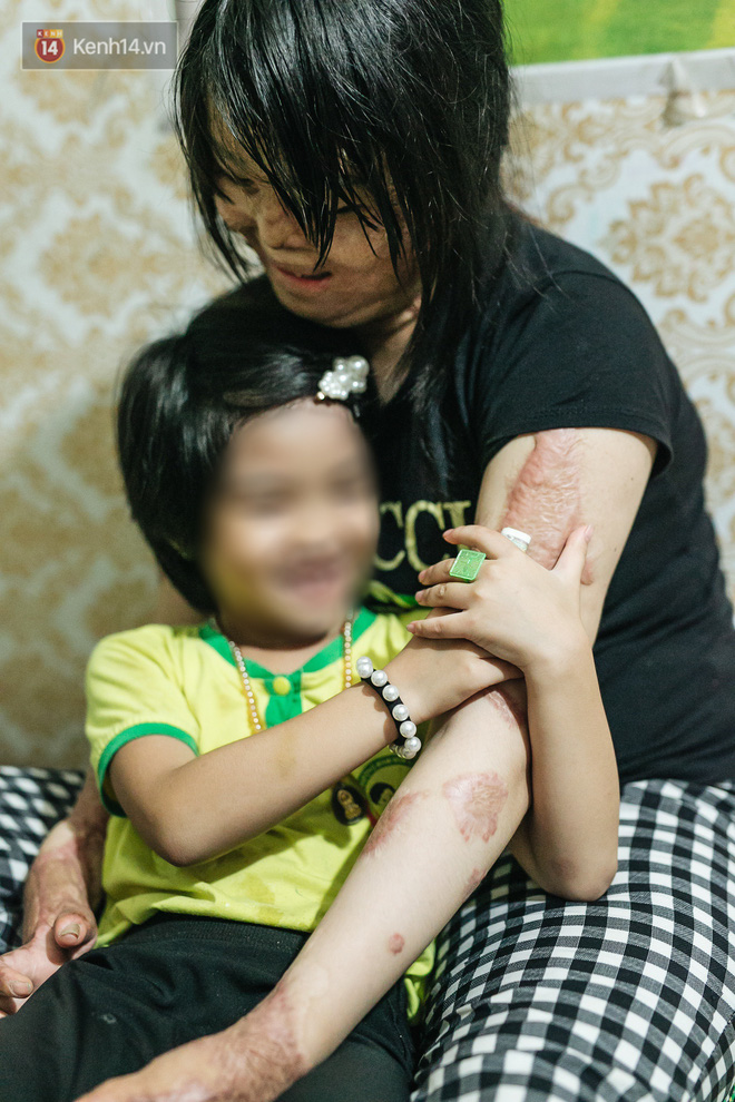 Cô gái trẻ bị chồng tưới xăng thiêu sống và lá thư muộn màng từ trại giam: 'Gần 3 năm anh chưa một lần dám viết thư cho em và hai con...' - 9 Cô gái trẻ bị chồng tưới xăng thiêu sống và lá thư muộn màng từ trại giam: 'Gần 3 năm anh chưa một lần dám viết thư cho em và hai con...' - 9