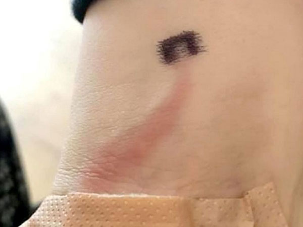 Một người mẹ chia sẻ hình ảnh của con trai và nhấn mạnh: Nếu thấy dấu hiệu này, cần nghĩ đến khả năng con bị nhiễm trùng huyết Một người mẹ chia sẻ hình ảnh của con trai và nhấn mạnh: Nếu thấy dấu hiệu này, cần nghĩ đến khả năng con bị nhiễm trùng huyết