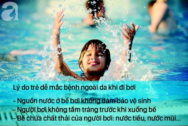 Trẻ đi bơi mùa hè, bác sĩ nhắc cẩn thận để không mắc 3 căn bệnh ngoài da thường gặp Trẻ đi bơi mùa hè, bác sĩ nhắc cẩn thận để không mắc 3 căn bệnh ngoài da thường gặp