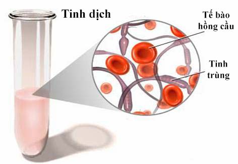 Cách ngừa và trị rối loạn xuất tinh Cách ngừa và trị rối loạn xuất tinh