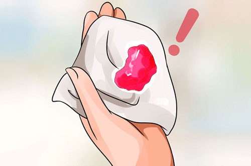 Tử cung của nữ giới có khỏe mạnh hay không, cứ nhìn vào 4 điểm này sẽ rõ - 2 Tử cung của nữ giới có khỏe mạnh hay không, cứ nhìn vào 4 điểm này sẽ rõ - 2
