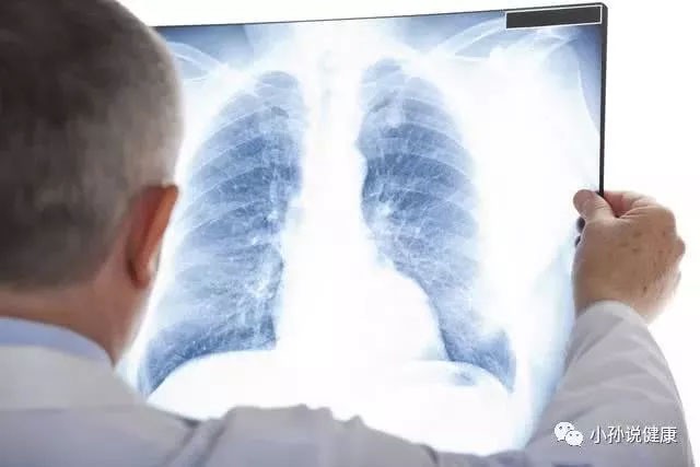 Chàng trai 18 tuổi mắc ung thư phổi dù không hút thuốc, uống rượu, bác sĩ chỉ ra những thủ phạm ít ai ngờ Chàng trai 18 tuổi mắc ung thư phổi dù không hút thuốc, uống rượu, bác sĩ chỉ ra những thủ phạm ít ai ngờ