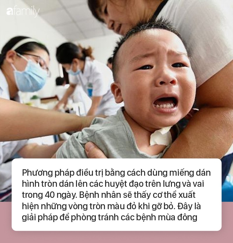 92 trẻ em bị bỏng rát sau khi dùng miếng dán tăng cường miễn dịch, chuyên gia khuyến cáo không được tự ý dùng! 92 trẻ em bị bỏng rát sau khi dùng miếng dán tăng cường miễn dịch, chuyên gia khuyến cáo không được tự ý dùng!