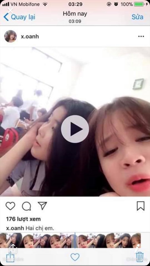 Khoe ảnh xinh đẹp cằm V-line, mũi thẳng dọc dừa, nữ sinh Sài Gòn bị dân mạng 'bóc phốt' phẫu thuật thẩm mỹ - 9 Khoe ảnh xinh đẹp cằm V-line, mũi thẳng dọc dừa, nữ sinh Sài Gòn bị dân mạng 'bóc phốt' phẫu thuật thẩm mỹ - 9