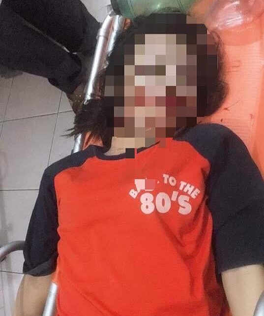 Vướng phải dây điện trên đường, nữ sinh 17 tuổi tử vong Vướng phải dây điện trên đường, nữ sinh 17 tuổi tử vong